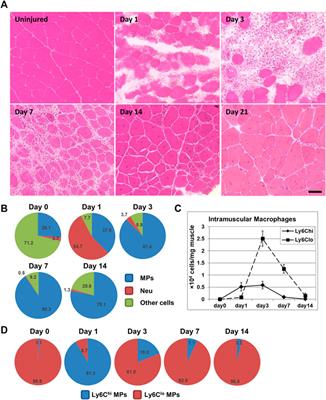 The Many Roles of Macrophages in Skeletal Muscle Injury and Repair